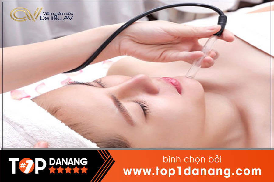 Lăn kim trị sẹo rỗ tại Đà Nẵng