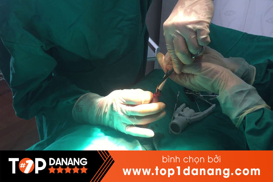 Cắt bao quy đầu ở bệnh viện Đà Nẵng
