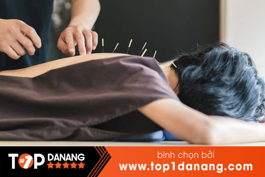 Châm cứu giỏi ở Đà Nẵng