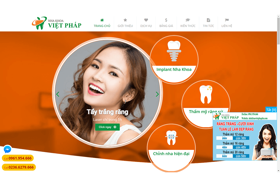 Nha Khoa Việt Pháp Cung cấp dịch vụ tẩy trắng răng Đà Nẵng